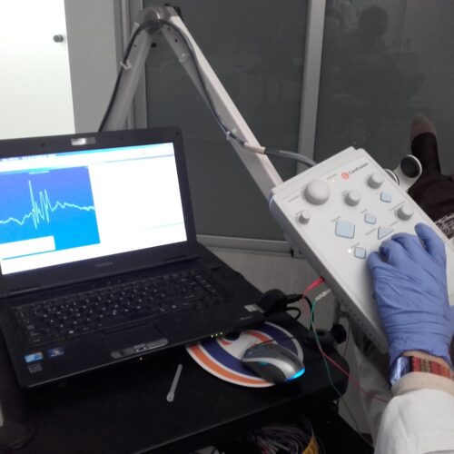 electromiograma2 La electromiografía y la resonancia magnética ayudan en el manejo de la lumbociatalgia, según el Dr. Pablo González Uriel