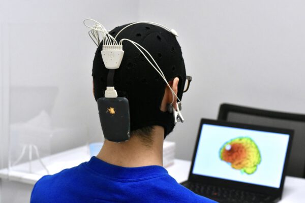 Paciente con el casco de electrodos durante una sesión de tDCS frente a un mapa cerebral en INCIA
